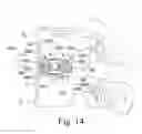 Fig. 07 - Expandable spinal implant and associated instrumentation