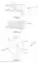 Fig. 05 - SPINAL IMPLANT