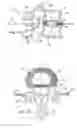 Fig. 02 - Systems and methods for augmenting intervertebral discs
