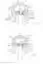 Fig. 05 - Systems and methods for augmenting intervertebral discs