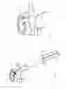 Fig. 07 - Systems and methods for augmenting intervertebral discs