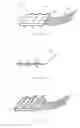 Fig. 11 - Systems and methods for augmenting intervertebral discs