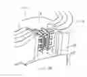 Fig. 22 - Systems and methods for augmenting intervertebral discs