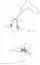Fig. 25 - Systems and methods for augmenting intervertebral discs