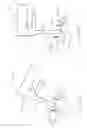 Fig. 28 - Systems and methods for augmenting intervertebral discs