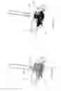 Fig. 30 - Systems and methods for augmenting intervertebral discs