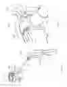 Fig. 32 - Systems and methods for augmenting intervertebral discs
