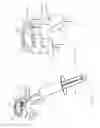 Fig. 35 - Systems and methods for augmenting intervertebral discs