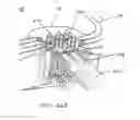 Fig. 40 - Systems and methods for augmenting intervertebral discs