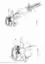 Fig. 61 - Systems and methods for augmenting intervertebral discs