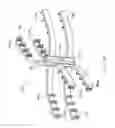 Fig. 63 - Systems and methods for augmenting intervertebral discs