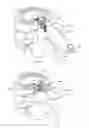 Fig. 65 - Systems and methods for augmenting intervertebral discs