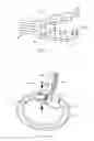 Fig. 67 - Systems and methods for augmenting intervertebral discs
