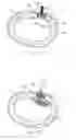 Fig. 69 - Systems and methods for augmenting intervertebral discs