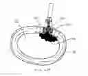 Fig. 70 - Systems and methods for augmenting intervertebral discs