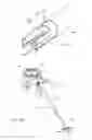 Fig. 80 - Systems and methods for augmenting intervertebral discs