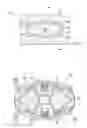 Fig. 04 - Multiple bearing implant