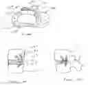 Fig. 02 - Intradiscal devices including spacers facilitating posterior-lateral and other insertion approaches