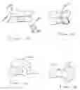 Fig. 08 - Intradiscal devices including spacers facilitating posterior-lateral and other insertion approaches