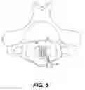 Fig. 09 - Implant