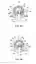 Fig. 05 - Devices, systems and methods for augmenting intervertebral discs