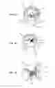 Fig. 06 - Devices, systems and methods for augmenting intervertebral discs