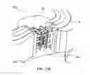 Fig. 22 - Devices, systems and methods for augmenting intervertebral discs