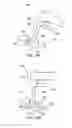 Fig. 28 - Devices, systems and methods for augmenting intervertebral discs