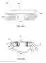 Fig. 71 - Devices, systems and methods for augmenting intervertebral discs