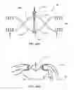 Fig. 72 - Devices, systems and methods for augmenting intervertebral discs
