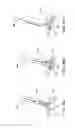 Fig. 74 - Devices, systems and methods for augmenting intervertebral discs