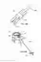 Fig. 82 - Devices, systems and methods for augmenting intervertebral discs