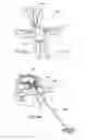 Fig. 83 - Devices, systems and methods for augmenting intervertebral discs