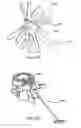 Fig. 84 - Devices, systems and methods for augmenting intervertebral discs