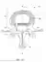 Fig. 04 - Method for delivering and positioning implants in the intervertebral disc environment