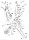 Fig. 01 - Modular total elbow prosthesis, humeral component and associated kit
