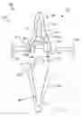 Fig. 04 - Modular total elbow prosthesis, humeral component and associated kit