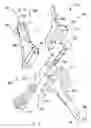 Fig. 06 - Modular total elbow prosthesis, humeral component and associated kit
