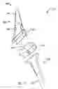 Fig. 10 - Modular total elbow prosthesis, humeral component and associated kit