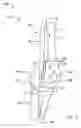 Fig. 12 - Modular total elbow prosthesis, humeral component and associated kit