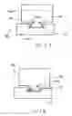 Fig. 13 - Modular total elbow prosthesis, humeral component and associated kit