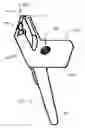 Fig. 17 - Modular total elbow prosthesis, humeral component and associated kit