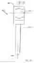 Fig. 20 - Modular total elbow prosthesis, humeral component and associated kit