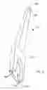 Fig. 23 - Modular total elbow prosthesis, humeral component and associated kit