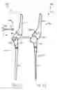 Fig. 28 - Modular total elbow prosthesis, humeral component and associated kit