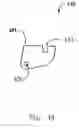 Fig. 40 - Modular total elbow prosthesis, humeral component and associated kit