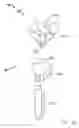 Fig. 48 - Modular total elbow prosthesis, humeral component and associated kit