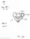 Fig. 49 - Modular total elbow prosthesis, humeral component and associated kit