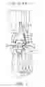 Fig. 02 - Total ankle arthroplasty