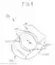 Fig. 08 - Total ankle arthroplasty